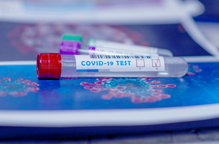 Klaidos, trukdančios gauti COVID-19 testų kompensaciją